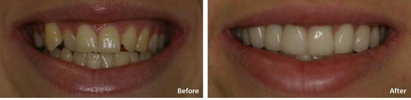 Sunshine Dental Laboratory