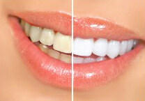 Waverley Park Dental Care