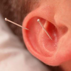 City Acupuncture Pain Clinic