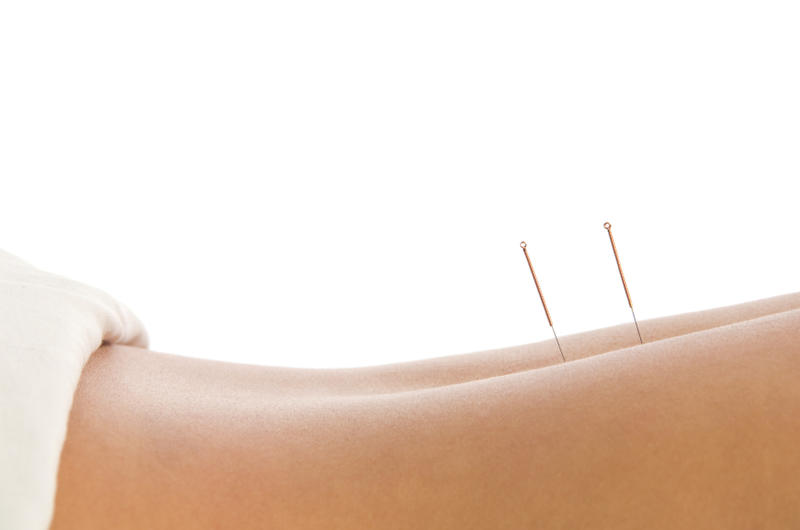 Susan Scollon Acupuncture