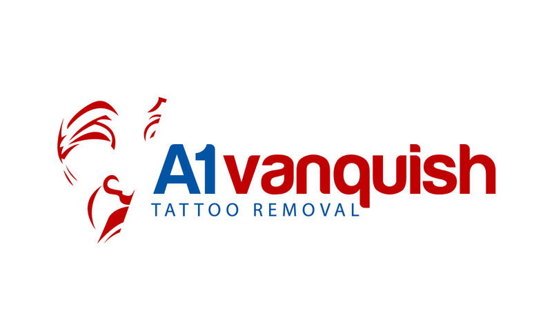 A1 Vanquish Tattoo Removal logo