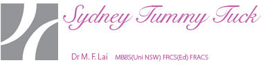 Sydney Tummy Tuck