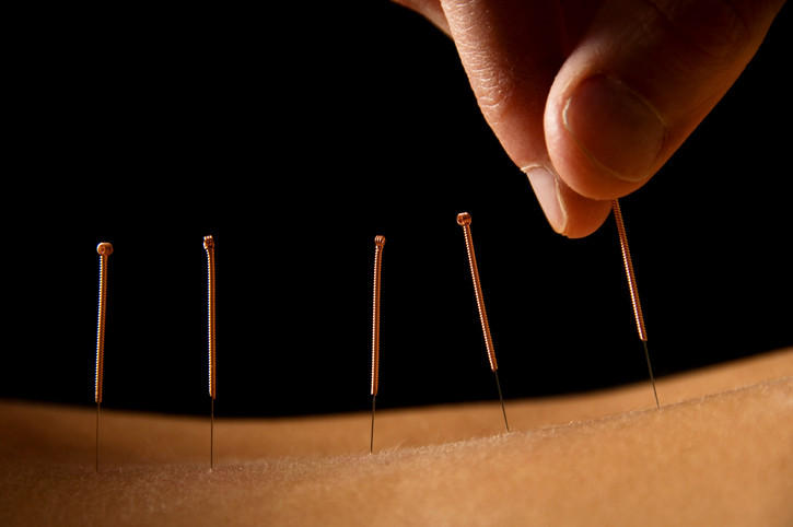 Mansfield Sports & Traditional Acupuncture