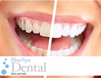 BlueSpa Dental: Melbourne logo