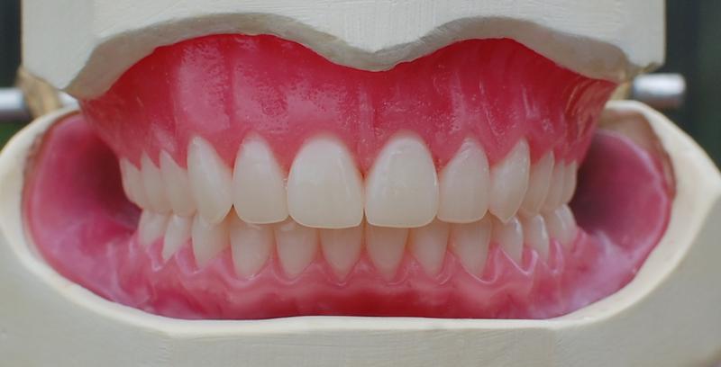 Denture Square