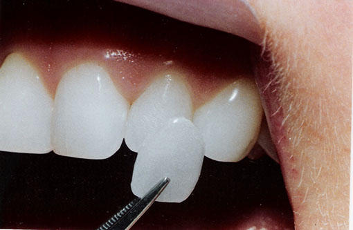 Ace Dental