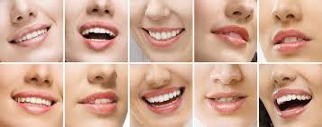 Bupa Dental: Hunters Hill