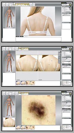Bondi Junction Skin Cancer Clinic