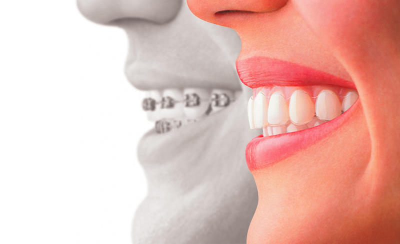 Orthodontist Cairns