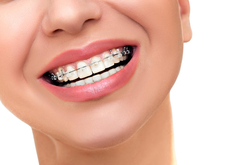 The Great Smile Orthodontist
