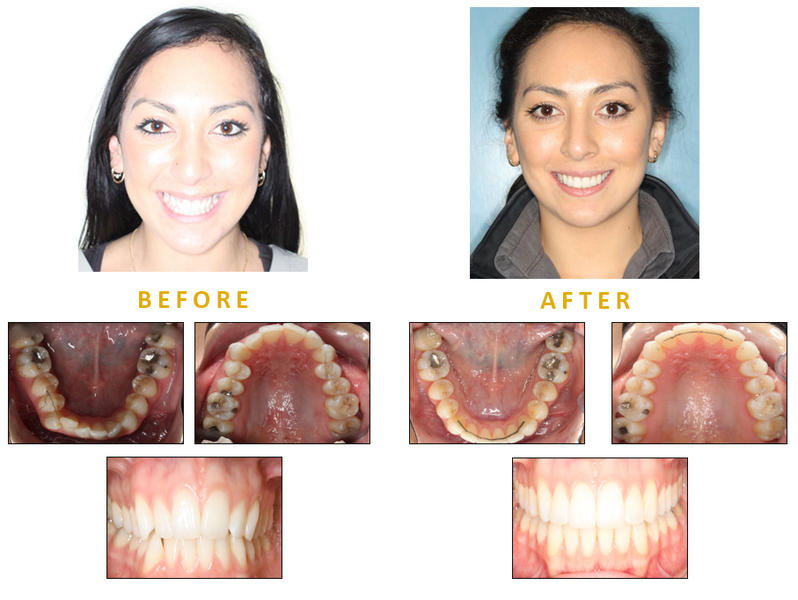 Perfect Smiles Orthodontics: Ballajura