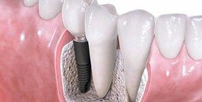 A2Z Dental: Rockhampton North