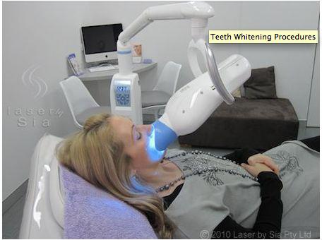 Teeth Whitening by Sia: Bondi Junction