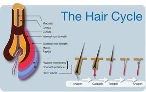 Hairfree: Mount Waverley