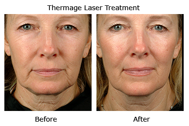 Jasmine Laser Clinics