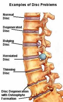 Aberfoyle Park Chiropractic