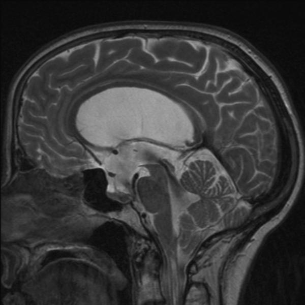 Gavin Davis: Neurosurgery logo