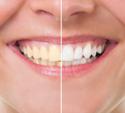 Bay Street Dental Group
