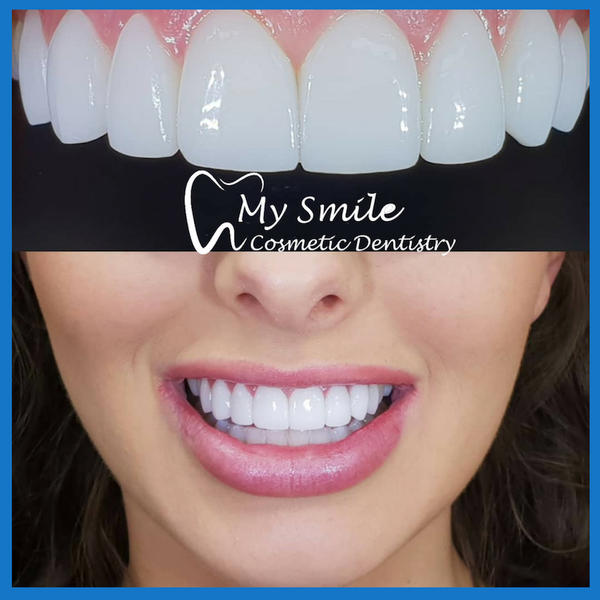 My Smile Cosmetic Dentistry