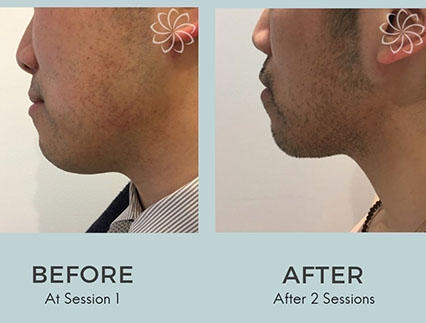 Body Catalyst Sydney CBD