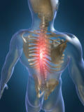 Spine Scan
