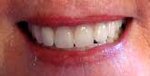 Affordable Dentist: Somerville