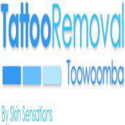 Tattoo Removal