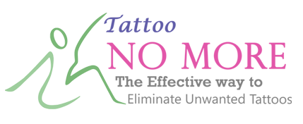 Tattoo No More: Perth