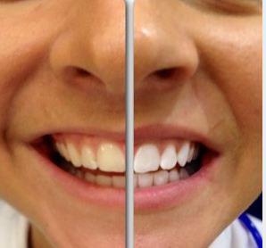 Pure Smile Pty Ltd
