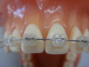 Harmony Orthodontics: South Perth