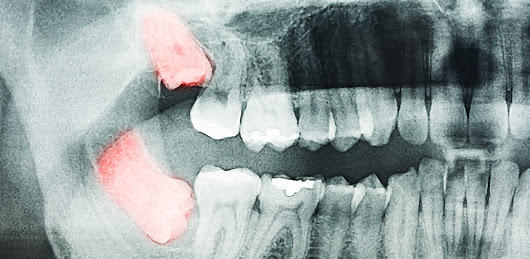Prahran Family Dental