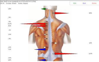 Fairfield Sports Chiropractor