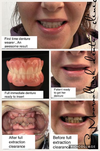 Mooroolbark Denture Clinic