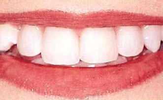 Carrara Dental Practice: Dr Mehran Shaibani