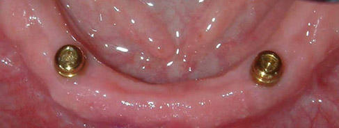 Patrick Davies Denture Clinic