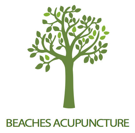 Acupuncture Bunbury