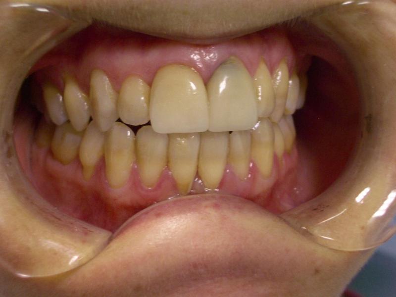 Ashmore City Dental
