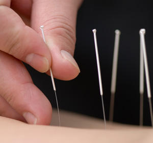 Best Acupuncture & Chinese Medicine Clinic