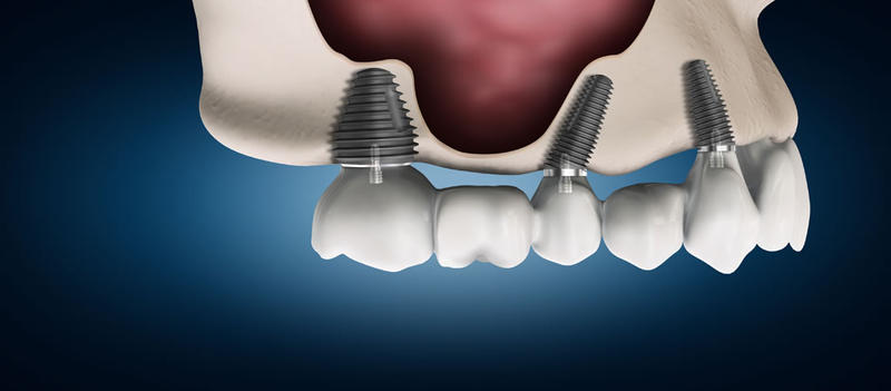 Dentistry Plus: Joondalup