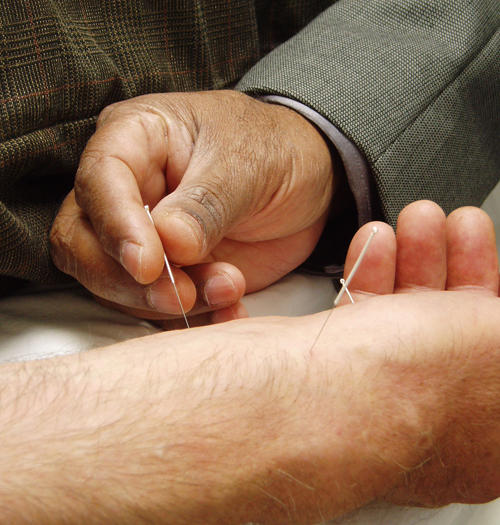 Acupuncture & Traditional Chinese Medicine