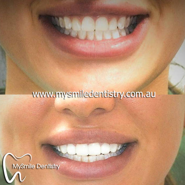 MySmile Dentistry