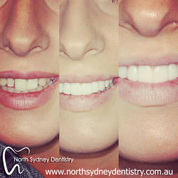 North Sydney Dentistry