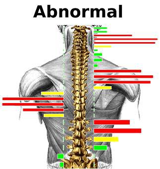 Spinecare Chiropractic: Morphett Vale