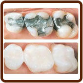 Greenslopes Dental