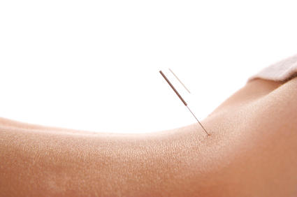 Bayside Acupuncture & Natural Medicine Qld