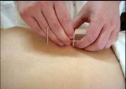 Zoneleader Acupuncture & Chinese Medcine Clinic