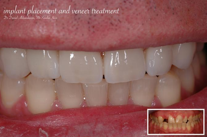 Accent Dental Care