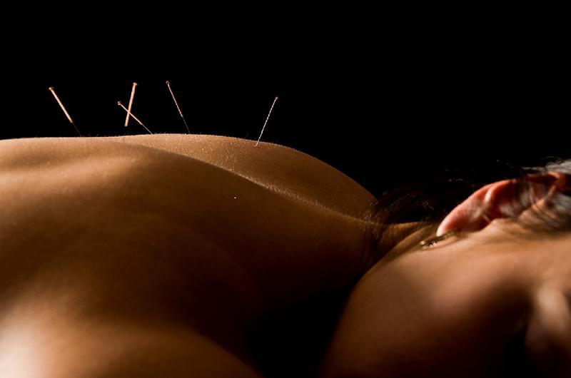 Jade Acupuncture