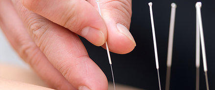 Sydney Acupuncture TCM Natural Health: Crows Nest