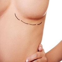 Plastic Surgeon Sydney